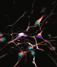 Recherche sur l’ARSACS publiée dans Stem Cells International