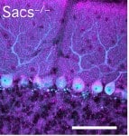 “A mitochondrial-targeted antioxidant improves motor coordination and reduces Purkinje cell death in a mouse model”